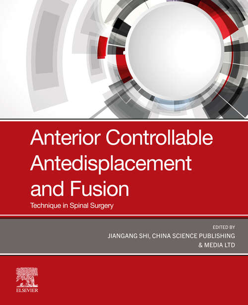 Book cover of Anterior Controllable Antedisplacement and Fusion (ACAF): Technique in Spinal Surgery