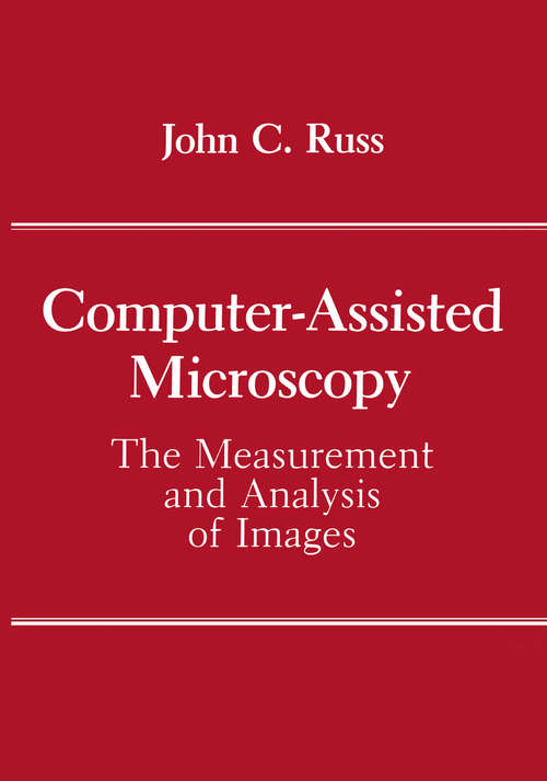 Book cover of Computer-Assisted Microscopy: The Measurement and Analysis of Images (1990)