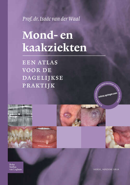 Book cover of Mond- en kaakziekten: Een atlas voor de dagelijkse praktijk (4th ed. 2017)