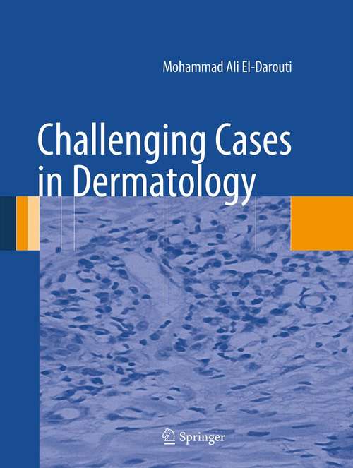 Book cover of Challenging Cases in Dermatology: Advanced Diagnoses And Management Tactics (2013)