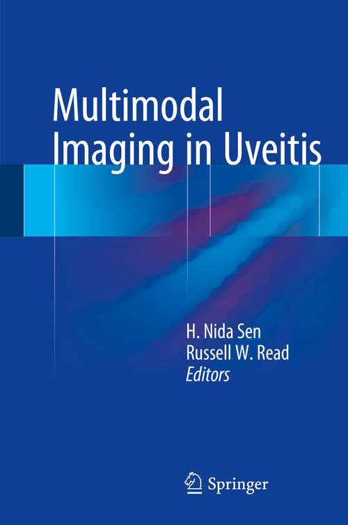Book cover of Multimodal Imaging in Uveitis