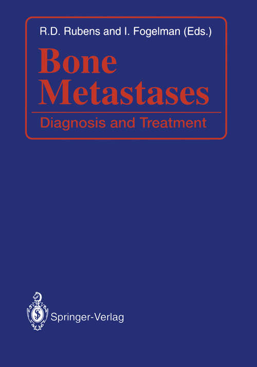 Book cover of Bone Metastases: Diagnosis and Treatment (1991)