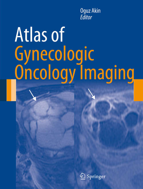 Book cover of Atlas of Gynecologic Oncology Imaging (2014) (Atlas of Oncology Imaging)