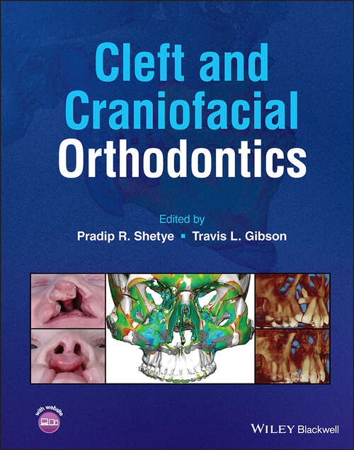 Book cover of Cleft and Craniofacial Orthodontics