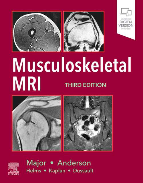 Book cover of Musculoskeletal MRI E-Book (3)