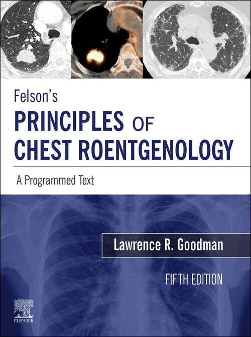 Book cover of Felson's Principles of Chest Roentgenology E-Book: Felson's Principles of Chest Roentgenology E-Book (5)