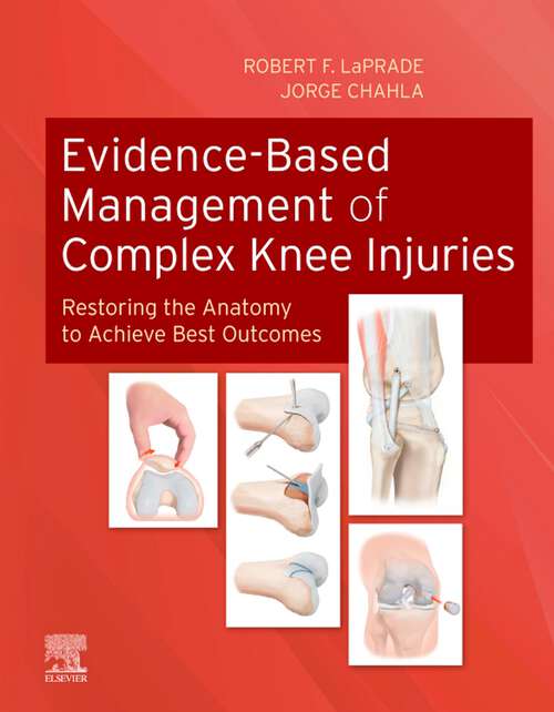 Book cover of Evidence-Based Management of Complex Knee Injuries E-Book: Restoring the Anatomy to Achieve Best Outcomes