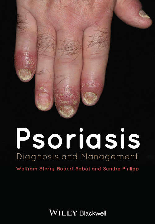 Book cover of Psoriasis: Diagnosis and Management