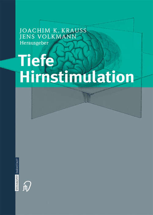 Book cover of Tiefe Hirnstimulation (2004)