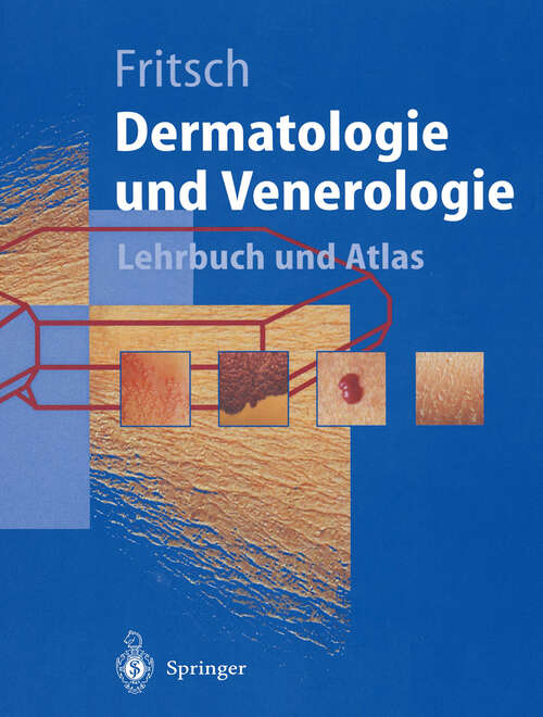 Book cover of Dermatologie und Venerologie: Lehrbuch und Atlas (1998) (Springer-Lehrbuch)