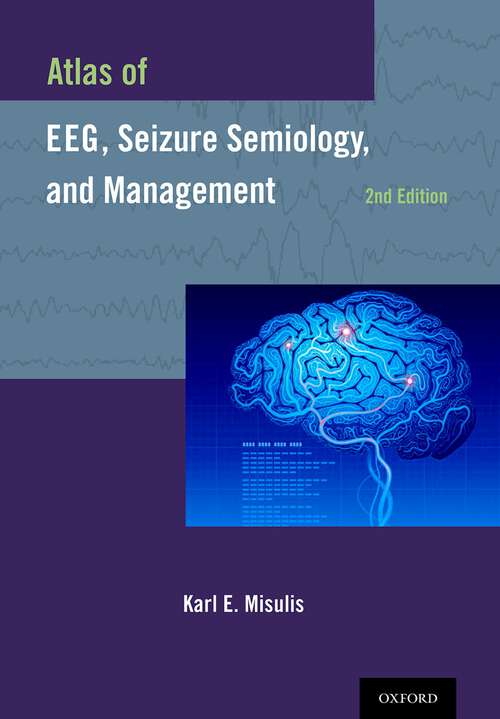 Book cover of Atlas of EEG, Seizure Semiology, and Management (2)