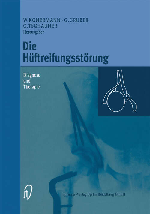 Book cover of Die Hüftreifungsstörung: Diagnose und Therapie (1999)