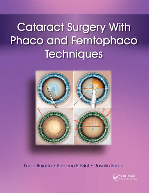 Book cover of Cataract Surgery With Phaco and Femtophaco Techniques