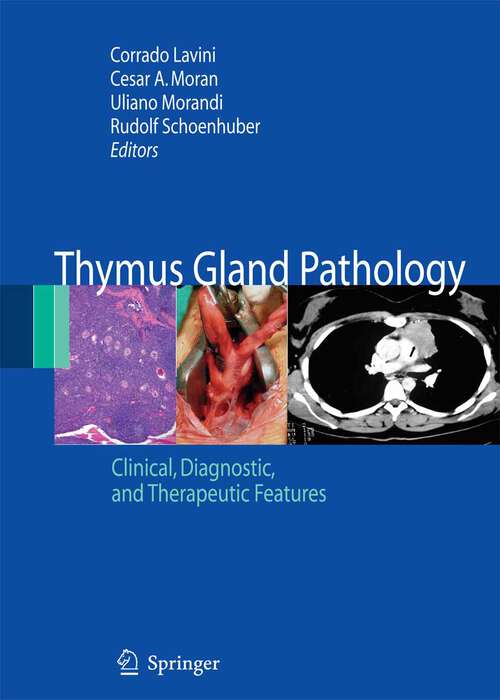 Book cover of Thymus Gland Pathology: Clinical, Diagnostic and Therapeutic Features (2008)