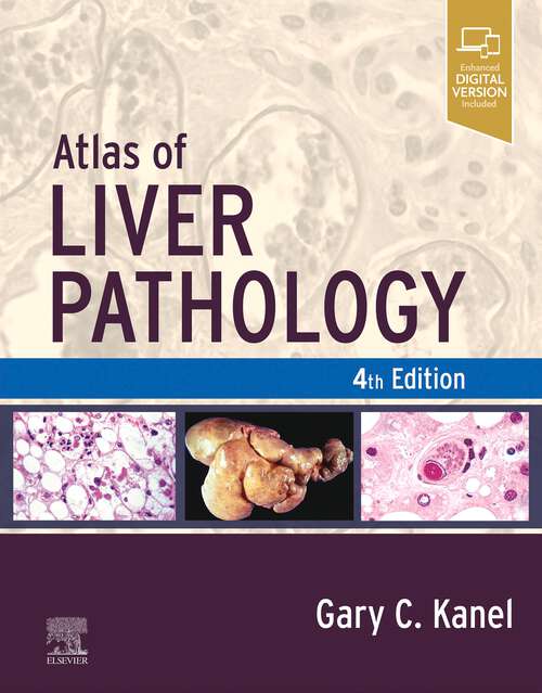 Book cover of Atlas of Liver Pathology - E-Book: Expert Consult - Online And Print (4) (Atlas of Surgical Pathology)