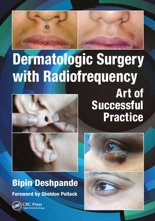 Book cover of Dermatologic Surgery with Radiofrequency: Art of Successful Practice