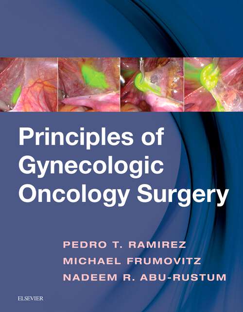 Book cover of Principles of Gynecologic Oncology Surgery E-Book