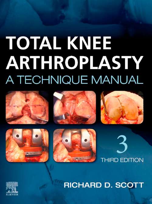 Book cover of Total Knee Arthroplasty E-Book: A Technique Manual (3) (Bristol-myers - Squibb-zimmer Orthopaedic Research Symposia Ser.)