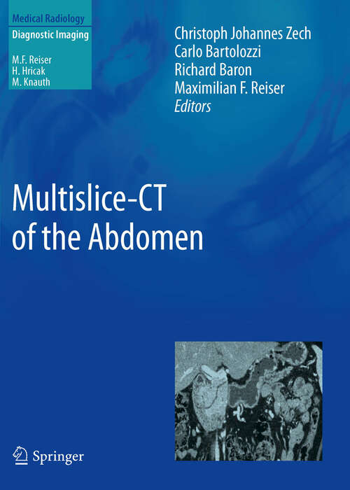 Book cover of Multislice-CT of the Abdomen (2012) (Medical Radiology)