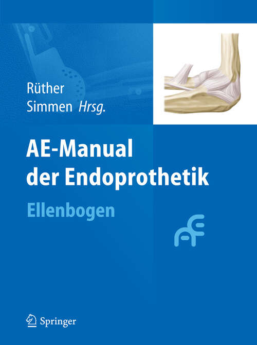 Book cover of AE-Manual der Endoprothetik: Ellenbogen (2013)