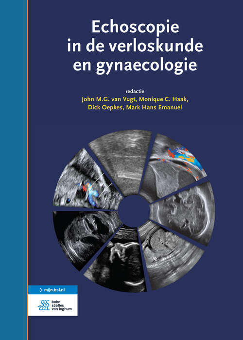 Book cover of Echoscopie in de verloskunde en gynaecologie (5th ed. 2016)