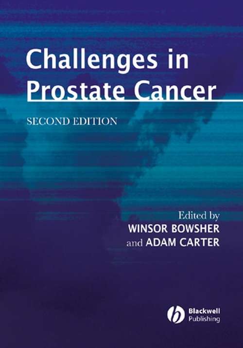 Book cover of Challenges in Prostate Cancer (2)