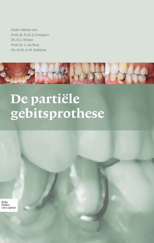 Book cover of De partiële gebitsprothese: uitgangspunten bij de diagnostiek en behandeling van het gemutileerde gebit (2010)