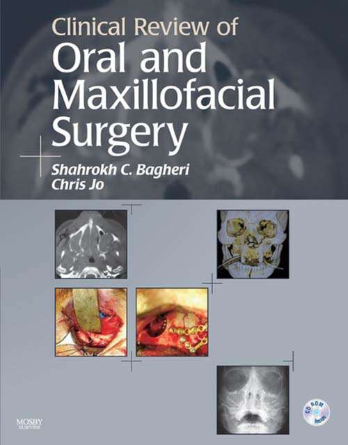 Book cover of Clinical Review of Oral and Maxillofacial Surgery - E-Book: Clinical Review of Oral and Maxillofacial Surgery - E-Book