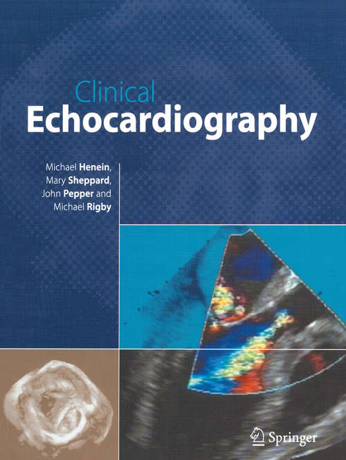 Book cover of Clinical Echocardiography (2004)