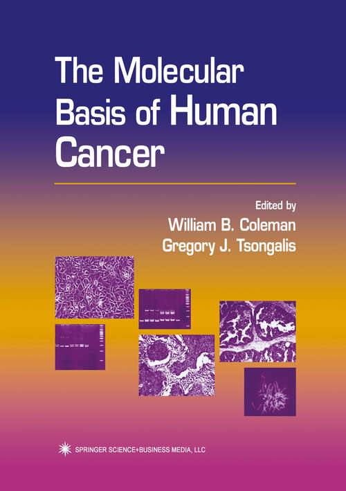 Book cover of The Molecular Basis of Human Cancer (2002)