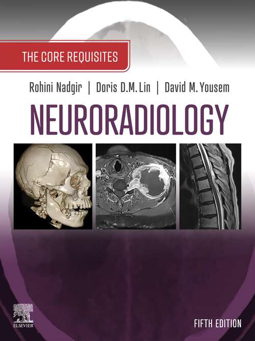 Book cover of Neuroradiology: The Core Requisites (5) (The Core Requisites)