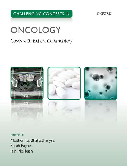 Book cover of Challenging Concepts in Oncology (Challenging Cases)