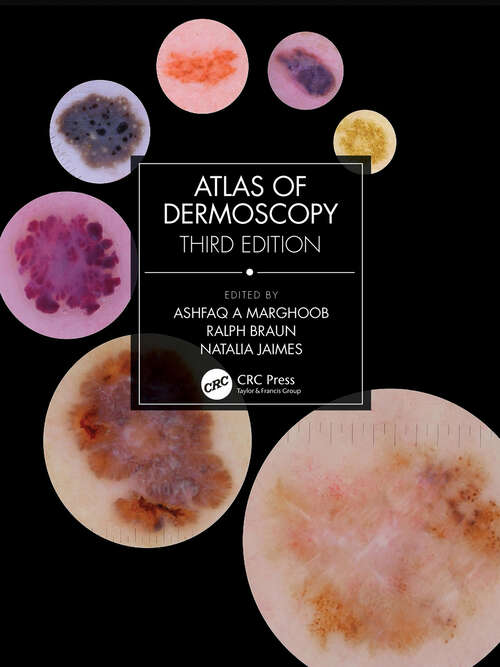 Book cover of Atlas of Dermoscopy: Third Edition (3)
