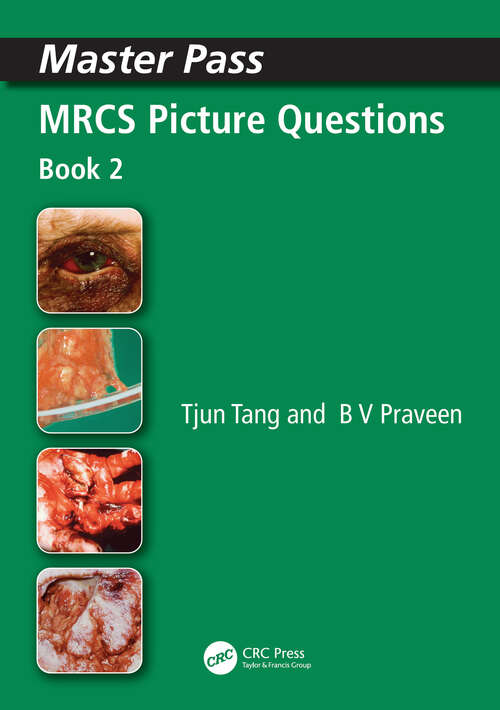 Book cover of MRCS Picture Questions: A Practical Guide, v. 3 (MasterPass)