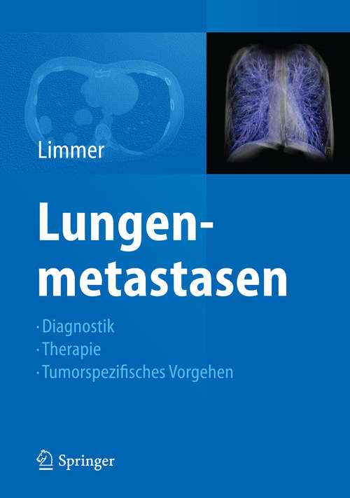 Book cover of Lungenmetastasen: Diagnostik -  Therapie - Tumorspezifisches Vorgehen (2015)