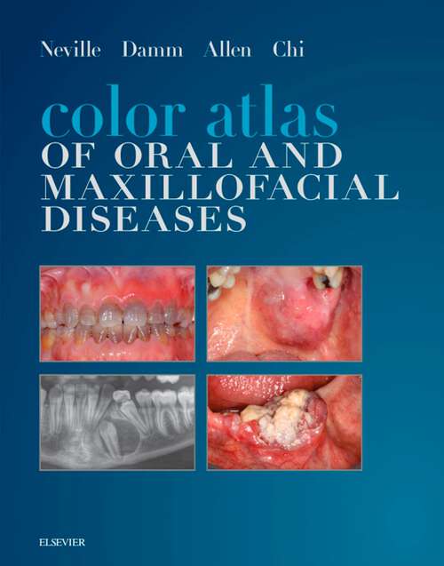 Book cover of Color Atlas of Oral and Maxillofacial Diseases - E-Book: Color Atlas of Oral and Maxillofacial Diseases - E-Book