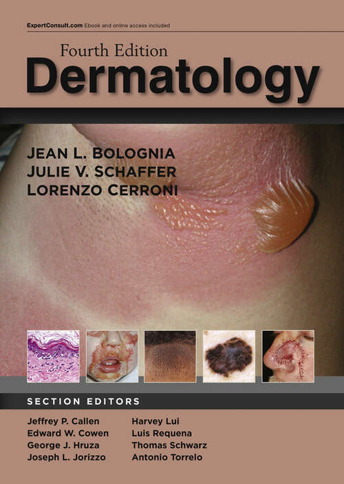 Book cover of Dermatology E-Book (4)