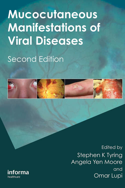 Book cover of Mucocutaneous Manifestations of Viral Diseases: An Illustrated Guide to Diagnosis and Management (2)