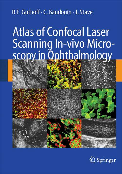 Book cover of Atlas of Confocal Laser Scanning In-vivo Microscopy in Ophthalmology (2006)