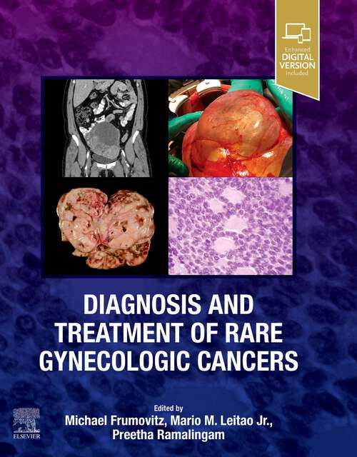 Book cover of Diagnosis and Treatment of Rare Gynecologic Cancers - E-Book