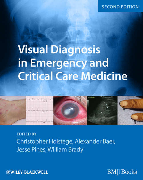 Book cover of Visual Diagnosis in Emergency and Critical Care Medicine (2)