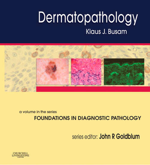 Book cover of Dermatopathology E-Book: A Volume in the Series: Foundations in Diagnostic Pathology (Foundations in Diagnostic Pathology)