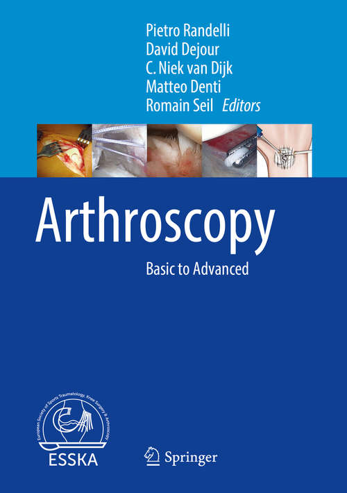 Book cover of Arthroscopy: Basic to Advanced (1st ed. 2016)