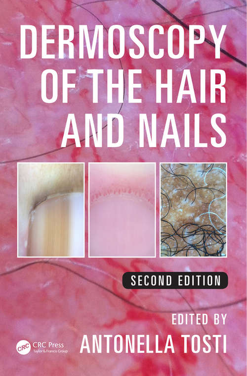 Book cover of Dermoscopy of the Hair and Nails (2)