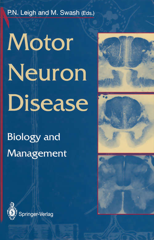 Book cover of Motor Neuron Disease: Biology and Management (1995)