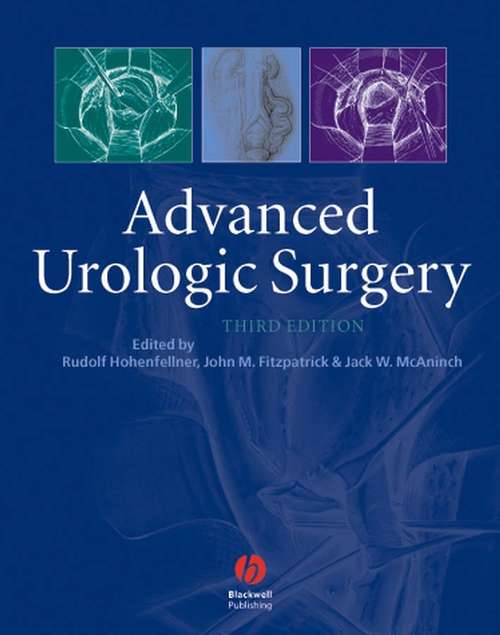 Book cover of Advanced Urologic Surgery (3)