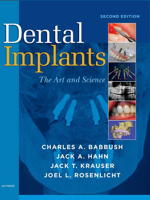 Book cover of Dental Implants: The Art and Science (2)