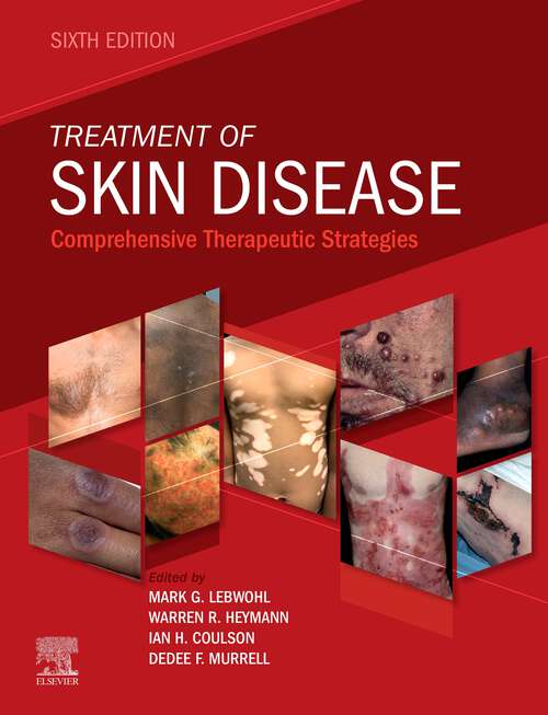 Book cover of Treatment of Skin Disease E-Book: Comprehensive Therapeutic Strategies (6)