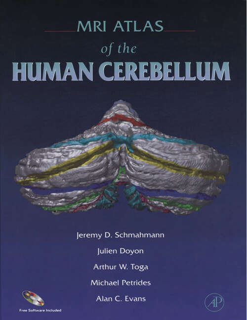 Book cover of MRI Atlas of the Human Cerebellum