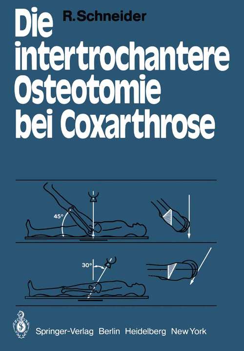 Book cover of Die intertrochantere Osteotomie bei Coxarthrose (1979)